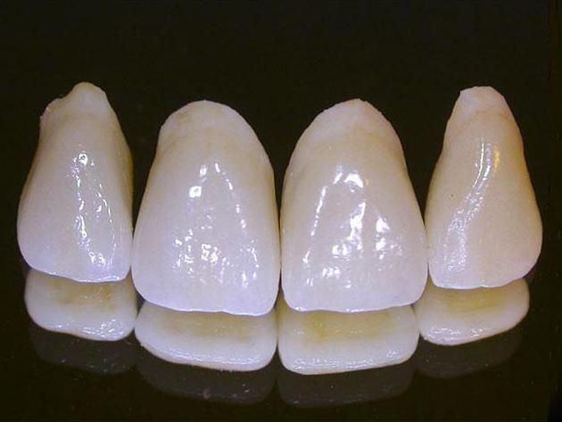 porslinskrona för tand