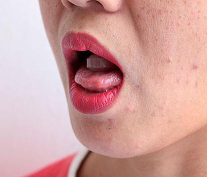 hur man bota stomatit i tungan